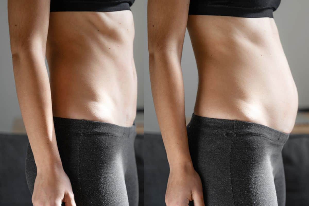 How long does diastasis recti take to improve Eaton?