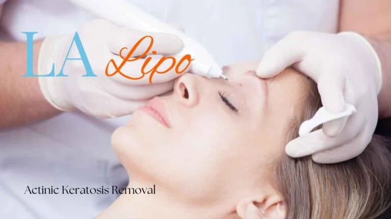 Woman receiving Actinic Keratosis Removal Treatment Eaton