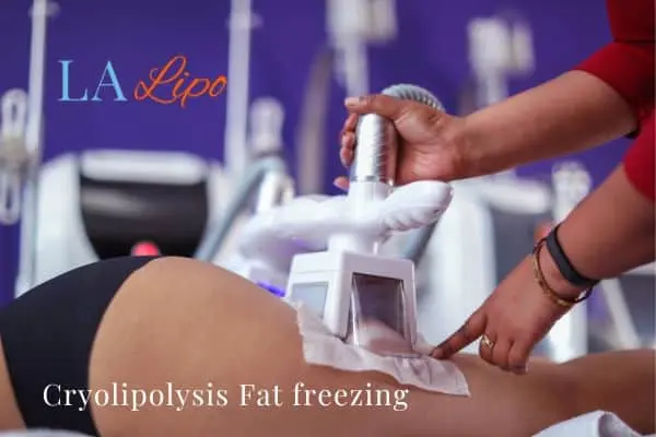women getting fat freezing Eaton