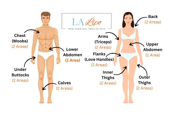 LA LIPO Cryolipolysis Areas Eaton