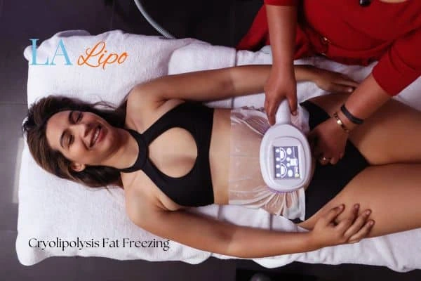 woman getting cryolipolysis Eaton