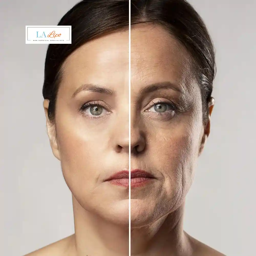 How Can You Tell If Non-Surgical Skin Tightening Is Right for You Eaton?