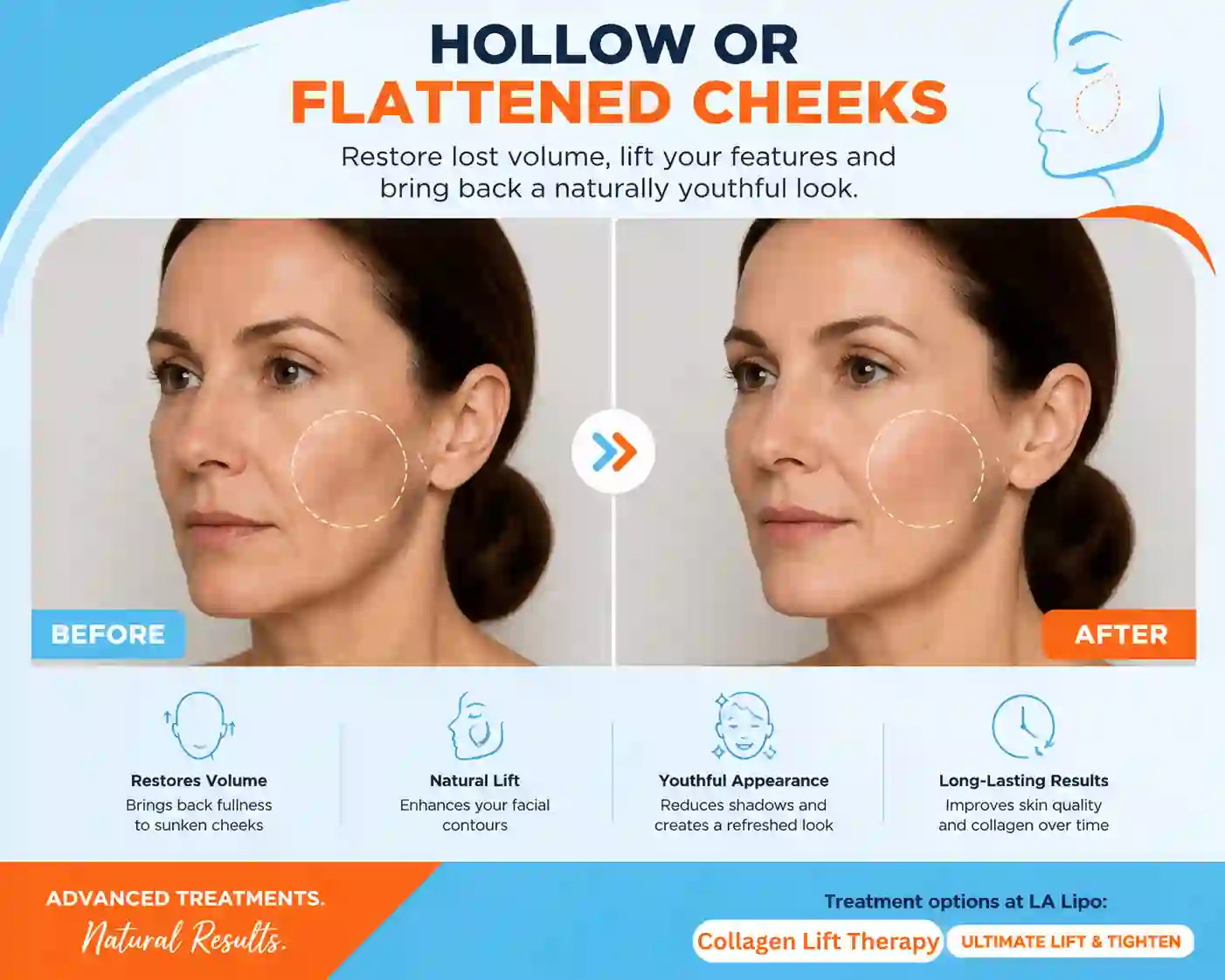 Sign #4: Hollow or Flattened Cheeks Eaton