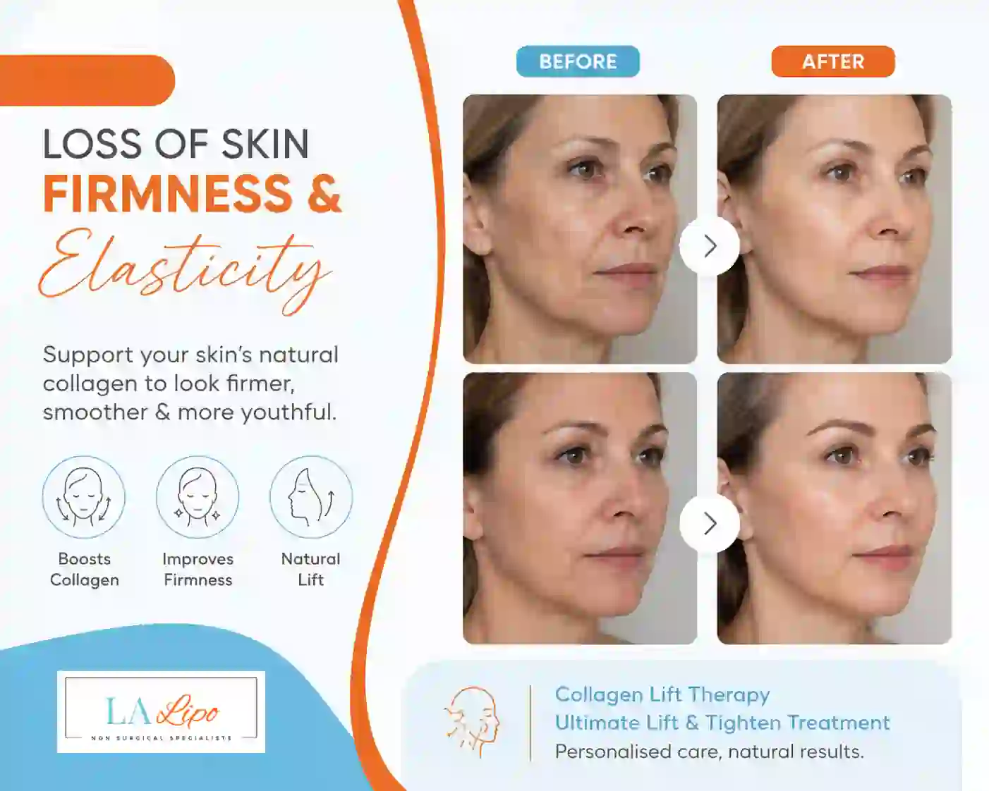 Sign #7: Loss of Skin Firmness and Elasticity Eaton